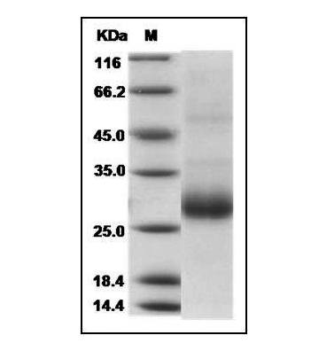 Fig.SDS-PAGE analysis of Human RANKL protein.