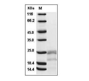 Fig.SDS-PAGE analysis of Human IFN-gamma protein.