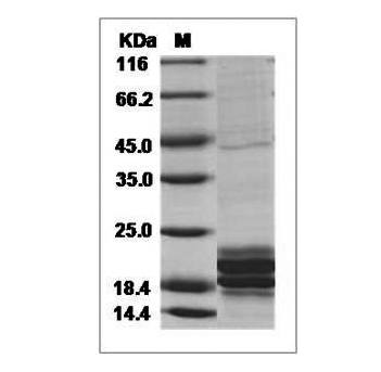 Fig.SDS-PAGE analysis of Human IL-17 protein, His Tag.