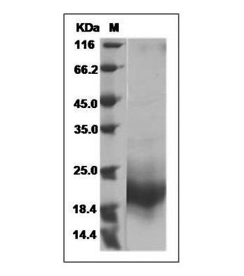 Fig.SDS-PAGE analysis of Mouse GM-CSF protein.