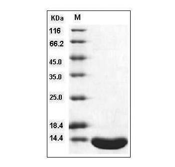 Fig.SDS-PAGE analysis of Human Leptin protein.