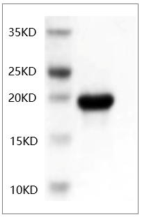 Fig.SDS-PAGE analysis of Human IL-6 protein.