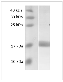 Fig. SDS-PAGE analysis of Human MCP2 protein, SUMO tag.