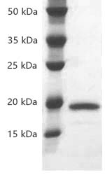 Fig.SDS-PAGE analysis of Human IL1-alpha/IL1A protein