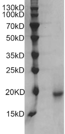 Fig.SDS-PAGE analysis of Human IL-18 protein