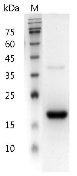 Fig.SDS-PAGE analysis of Human IFN-β1a protein