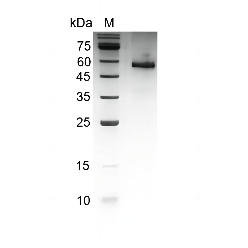 Fig.SDS-PAGE analysis of Human Noggin protein