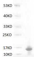 Fig.SDS-PAGE analysis of Human S100A9 Protein