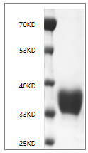 SDS-PAGE Human CD274/PD-L1 protein