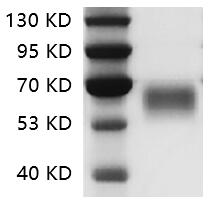 Fig.SDS-PAGE analysis of Human CD28 protein.