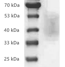 Fig.SDS-PAGE analysis of Human CD226/DNAM-1 protein, His tag