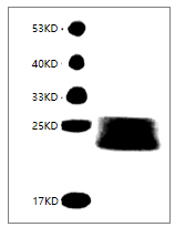 Fig. SDS-PAGE analysis of Mouse IL-6 protein, His tag.