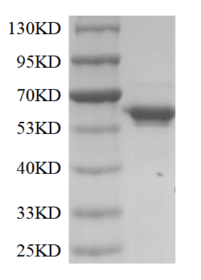 Fig. SDS-PAGE analysis of TdT.