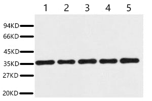 A01021.jpg&&Fig. Western blot analysis of 293T (1), Rat brain (2), NIH 3T3 (3), Sheep Muscle (4), Rabbit testis (5), diluted at 1:20000. Secondary antibody was diluted at 1:20000.