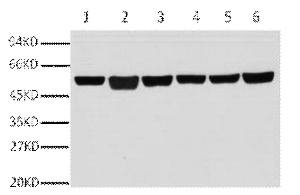 A01030-1.jpg&&Fig.1. Western blot analysis of A549(1), rat brain (2), mouse brain (3), chicken lung (4) and rabbit testis(5), sheep muscle(6), diluted at 1:10000.|||A01030-2.jpg&&Fig.2. Immunofluorescence analysis of human appendix tissue. 1, ?-Tubulin Monoclonal Antibody (3G6) (red) was diluted at 1:400 (4�C, overnight). Picture A: Target. Picture B: DAPI. Picture C: merge of A+B.|||A01030-3.jpg&&Fig.3. Immunofluorescence analysis of mouse lung tissue. 1, ?-Tubulin Monoclonal Antibody (3G6) (red) was diluted at 1:400 (4�C, overnight). Picture A: Target. Picture B: DAPI. Picture C: merge of A+B.|||A01030-4.jpg&&Fig.4. Immunohistochemical analysis of paraffin-embedded human colon tissue. 1, ?-Tubulin Monoclonal Antibody (3G6) was diluted at 1:400 (4�C, overnight). Negative control was used by secondary antibody only.|||A01030-5.jpg&&Fig.5. Immunohistochemical analysis of paraffin-embedded mouse testis tissue. 1, ?-Tubulin Monoclonal Antibody (3G6) was diluted at 1:400 (4�C, overnight). Negative control was used by secondary antibody only.|||A01030-6.jpg&&Fig.6. Immunohistochemical analysis of paraffin-embedded rat lung tissue. 1, ?-Tubulin Monoclonal Antibody (3G6) was diluted at 1:400 (4�C, overnight). Negative control was used by secondary antibody only.
