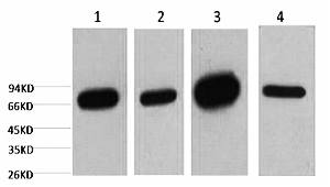A01090-1.jpg&&Fig.1. Western blot analysis of 1) HepG2, 2) 293T, 3) mouse brain tissue, 4) rat brain tissue, diluted at 1:5000.|||A01090-2.jpg&&Fig.2 Immunofluorescence analysis of human lung cancer tissue. 1, Lamin B1 Monoclonal Antibody (15T1) (red) was diluted at 1:200 (4�C, overnight). 2, Cy3 Labeled secondary antibody was diluted at 1:300 (room temperature, 50min). 3, Picture B: DAPI (blue) 10min. Picture A: Target. Picture B: DAPI. Picture C: merge of A+B.|||A01090-3.jpg&&Fig.3. Immunohistochemical analysis of paraffin-embedded human uterus tissue. 1, Lamin B1 Monoclonal Antibody (15T1) was diluted at 1:200 (4�C, overnight). 2, Sodium citrate pH 6.0 was used for antibody retrieval (>98�C, 20min). 3, secondary antibody was diluted at 1:200 (room temperature, 30min). Negative control was used by secondary antibody only.