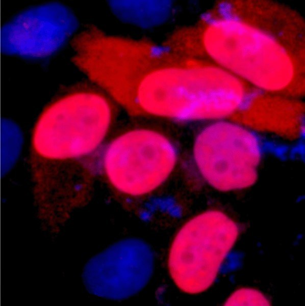 A02010-if.jpg&&Fig.1. Immunofluorescence staining (1:4000) of Flag fusion protein in 293 cells and counterstained with DAPI.|||A02010-wb.jpg&&Fig.2. IP (1:400)-WB (1:10000) analysis of Flag fusion protein expression in 293 cells. Untransfected 293 cell lysate (lane A), transfected 293 cell lysate with Flag-tag protein (lane B), IP transfected 293 with normal Mouse IgG and Protein G agarose (lane C), IP transfected 293 with Anti Flag tag mAb and Protein G agarose (lane D), and IP transfected 293 with only Protein G agarose (lane E).