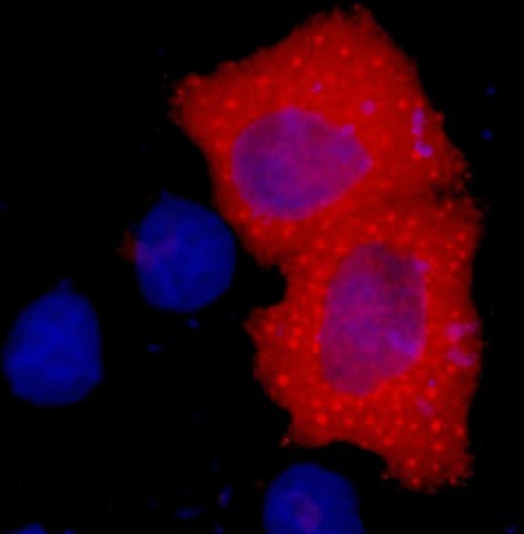 A02040-if.jpg&&Fig.1. Immunofluorescence staining (1:2000) of HA fusion protein in 293 cells with red and counterstained with DAPI.|||A02040-wb.jpg&&Fig.2.IP (1:400)-WB (1:10000) analysis of HA fusion protein expression in 293 cells. Untransfected 293 cell lysate (lane A), transfected 293 cell lysate with HA-tag protein (lane B); IP untransfected 293 cell lysate with Anti HA tag mAb (lane C); IP transfected 293 cell lysate with normal Mouse IgG (lane D), or with Anti HA tag mAb (lane E), and IP transfected 293 without both normal Mouse IgG and HA tag mAb (lane F).
