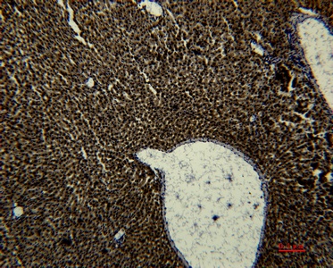 转铁蛋白单克隆抗体 - 亚科因(abbkine)—服务于细胞和蛋白研究全球