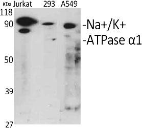 Abp51894-1.jpg&&Fig.1. Western Blot analysis of various cells using Na+/K+-ATPase alpha1 Polyclonal Antibody diluted at 1:1000.|||Abp51894-2.jpg&&Fig.2. Western Blot analysis of 293 cells using Na+/K+-ATPase alpha1 Polyclonal Antibody diluted at 1:1000.