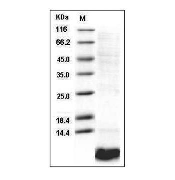 PRP100159-1.jpg&&Fig.SDS-PAGE analysis of Human EGF protein.