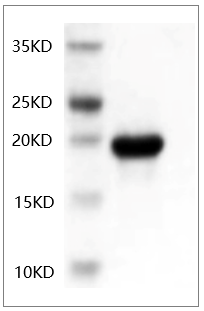 PRP1012.png&&Fig.SDS-PAGE analysis of Human IL-6 protein.