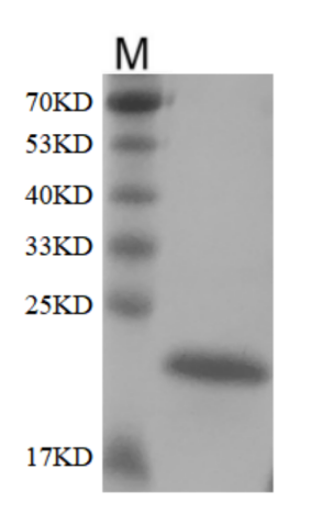 PRP1030.png&&Fig. SDS-PAGE analysis of Human FGF21 protein.