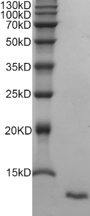 PRP1211.png&&Fig.SDS-PAGE analysis of Rat EGF protein