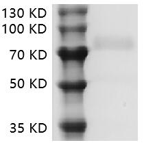 PRP2030.jpg&&Fig.SDS-PAGE analysis of Human CD19 protein.