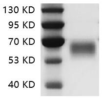 PRP2031.jpg&&Fig.SDS-PAGE analysis of Human CD28 protein.