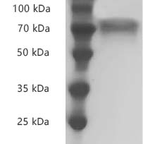 PRP2034.jpg&&Fig.SDS-PAGE analysis of Human CD30/TNFRSF8 protein