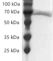 PRP2036.jpg&&Fig.SDS-PAGE analysis of Human CD73/NT5E protein, His tag