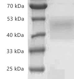 PRP2037.jpg&&Fig.SDS-PAGE analysis of Human CD84/SLAMF5 protein, His tag