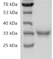 PRP2039.jpg&&Fig.SDS-PAGE analysis of Recombinant SARS-CoV-2 Spike RBD Protein, His tag