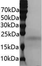 PRP2116.jpg&&Fig.SDS-PAGE analysis of Mouse GM-CSF protei.