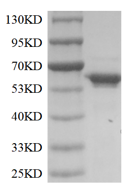 PRP3002.png&&Fig. SDS-PAGE analysis of TdT.