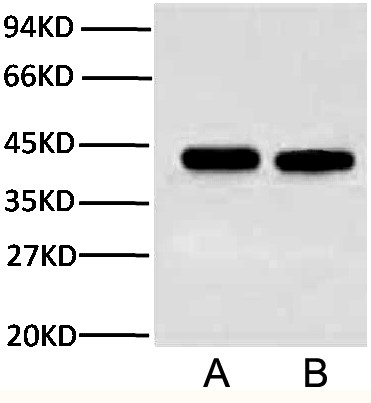 Anti-Plant Actin Mouse Monoclonal Antibody (3T3), another scientific breakthrough from Abbkine Scientific Company Limited