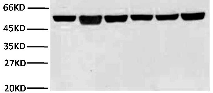 New Anti-β-Tubulin Mouse Monoclonal Antibody (3G6) has been released by Abbkine