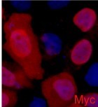 Abbkine Scientific achieves another milestone with the Anti-Myc Tag Mouse Monoclonal Antibody (2D5)
