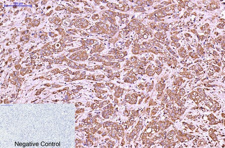 Abbkine Scientific launches the Cytokeratin 6 Monoclonal Antibody