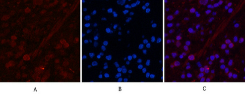 Peroxiredoxin 1 Monoclonal Antibody – the latest addition to the Abbkine family