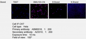Superkine™ Enhanced Antibody Diluent (BMU103-CN) was compared to a generic antibody diluent (TBST) and a comparable competitor (Brand B, Brand A) in a WB test