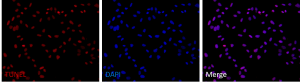 TUNEL Apoptosis Detection Kit (Orange Fluorescence)